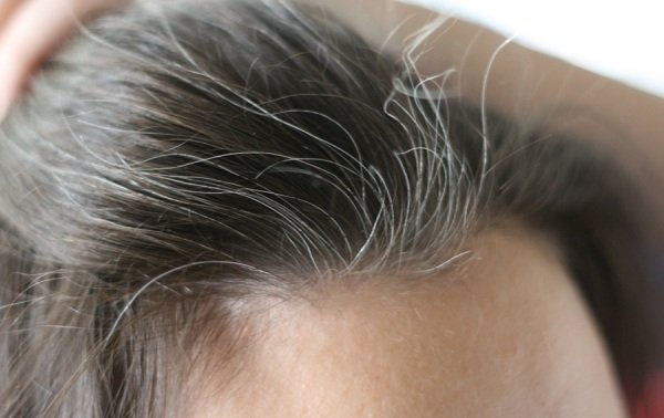 Các mẹo loại bỏ lo ngại tóc bạc sớm cho bạn